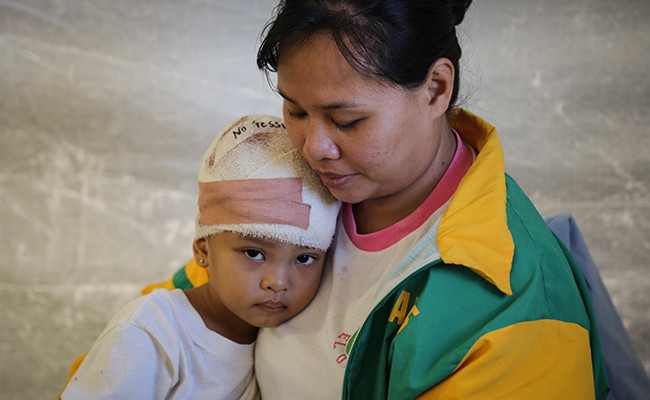 Alisa, who required an operation to remove a piece of wood lodged in her skull