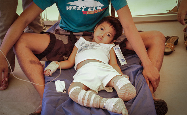 4 year old boy called William, after surgery on his leg